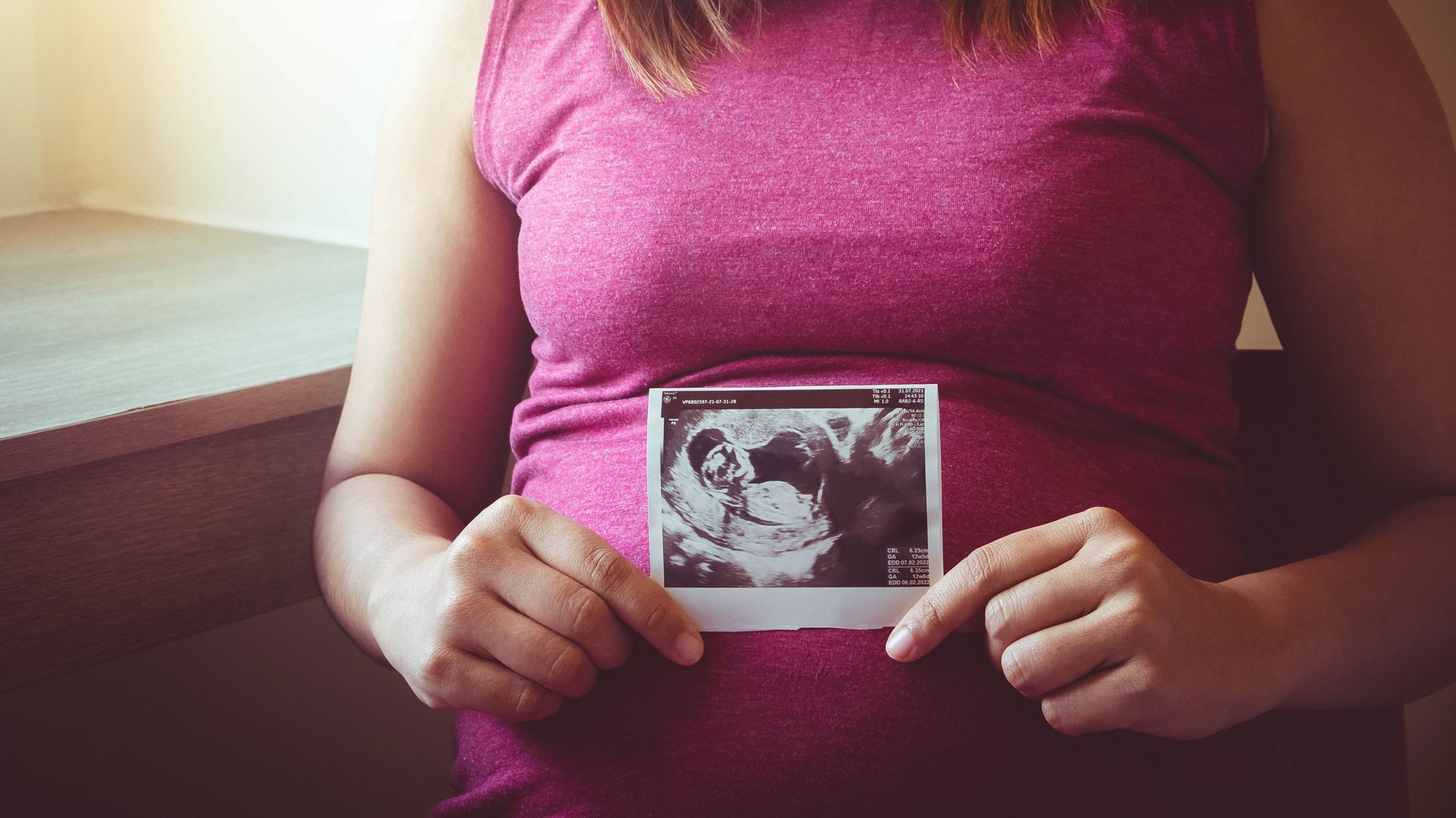 Eine schwangere Frau hält ein Ultraschall-Bild vor ihren Bauch